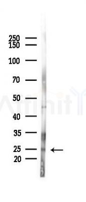 Phospho-MOB1A (Tyr26) Antibody - Western blot analysis of lysates from Rat testis, using Phospho-MOB1A (Tyr26) Antibody at 1/1000 dilution.