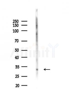 Phospho-TMEM173/STING (Ser366) Antibody - Western blot analysis of lysates from PC12 cells(UV 30min treatment), using Phospho-TMEM173/STING (Ser366) Antibody at 1/1000 dilution.