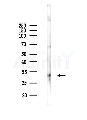 Phospho-TMEM173/STING (Ser366) Antibody - Western blot analysis of lysates from RAW264.