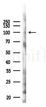 Phospho-KSR1 (Ser569) Antibody - Western blot analysis of lysates from HUVEC cells(UV 30min treatment), using Phospho-KSR1 (Ser569) Antibody at 1/1000 dilution.