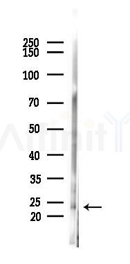 Phospho-NT5C (Ser184) Antibody - Western blot analysis of lysates from Rat testis, using Phospho-NT5C (Ser184) Antibody at 1/1000 dilution.
