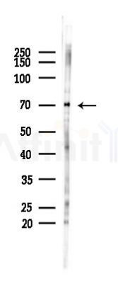 Phospho-DNAJC2/MPP11 (Ser49) Antibody - Western blot analysis of lysates from COLO205 cells(heat-shock 45min treatment), using Phospho-DNAJC2/MPP11 (Ser49) Antibody at 1/1000 dilution.