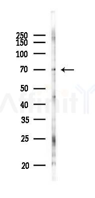 Phospho-DNAJC2/MPP11 (Ser49) Antibody - Western blot analysis of lysates from HUVEC cells(UV 30min treatment), using Phospho-DNAJC2/MPP11 (Ser49) Antibody at 1/1000 dilution.