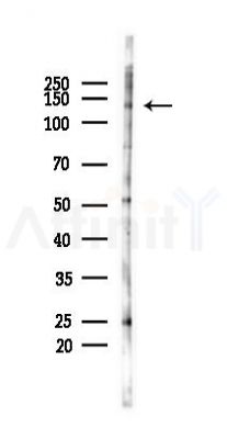 Phospho-Nephrin (Ser432) Antibody  - Western blot analysis of lysates from COLO205 cells(heat-shock 45min treatment), using Phospho-Nephrin (Ser432) Antibody  at 1/1000 dilution.