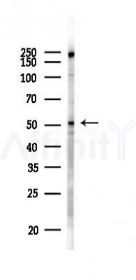 KLF5 Antibody - Western blot analysis of lysates from HUVEC cells(UV 30min treatment), using KLF5 Antibody at 1/1000 dilution.