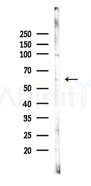SLC22A8 Antibody - Western blot analysis of lysates from 293 cells(UV 30min treatment), using SLC22A8 Antibody at 1/1000 dilution.