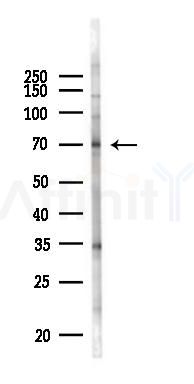 ADAM9 Antibody - Western blot analysis of lysates from HUVEC cells(UV 30min treatment), using ADAM9 Antibody at 1/1000 dilution.