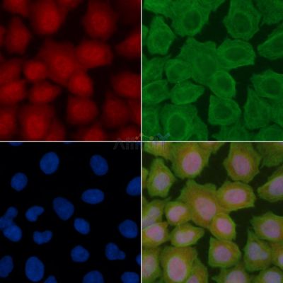 FOXO3A Antibody - AF7624 staining Hela cells(30min of UV treatment) by IF/ICC.