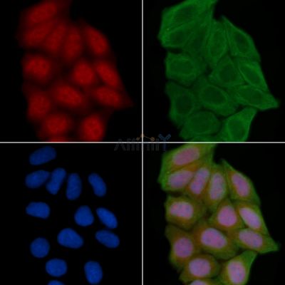 CTNND1 Antibody - AF7637 staining Hela cells(30min of UV treatment) by IF/ICC.