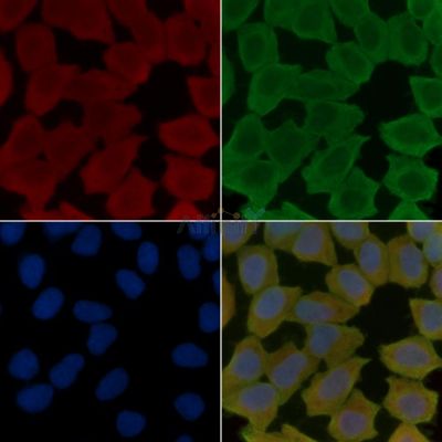 ULK1 Antibody - AF7647 staining Hela cells(30min of UV treatment) by IF/ICC.