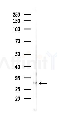 PZR Antibody - Western blot analysis of lysates from Rat muscle, using PZR Antibody at 1/1000 dilution.