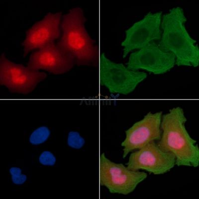 Nucleophosmin Antibody - AF7703 staining Hela cells(30min of UV treatment) by IF/ICC.