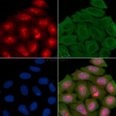 PKM2 Antibody - AF7729 staining Hela cells(30min of UV treatment) by IF/ICC.