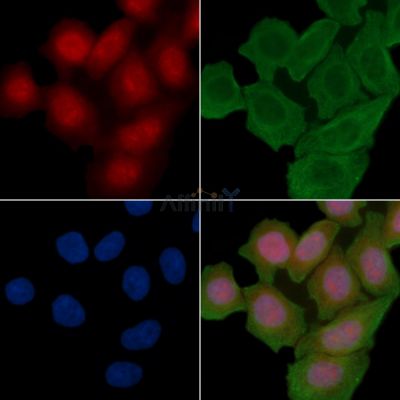 JunB Antibody - AF7742 staining Hela cells(30min of UV treatment) by IF/ICC.