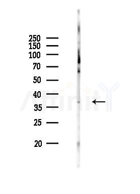 PKA alpha/beta/gamma CAT Antibody - Western blot analysis of lysates from Mouse heart, using PKA alpha/beta/gamma CAT Antibody at 1/1000 dilution.
