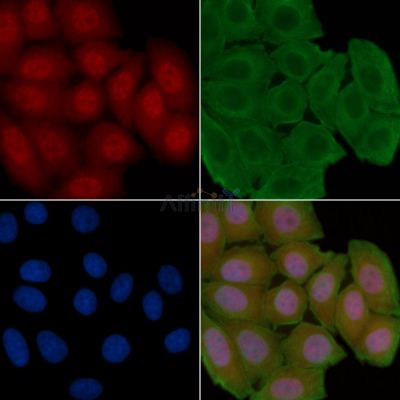 BCL-3 Antibody - AF7756 staining Hela cells(30min of UV treatment) by IF/ICC.