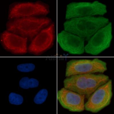 EPHA2 Antibody - AF7784 staining Hela cells(30min of UV treatment) by IF/ICC.