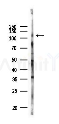 EPHA3 Antibody - Western blot analysis of lysates from HUVEC cells(UV 30min treatment), using EPHA3 Antibody at 1/1000 dilution.