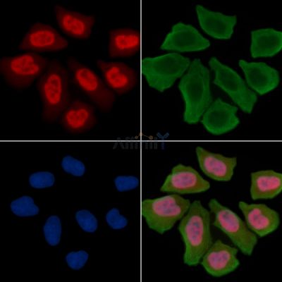 MAPKAPK2 Antibody - AF7809 staining Hela cells(30min of UV treatment) by IF/ICC.
