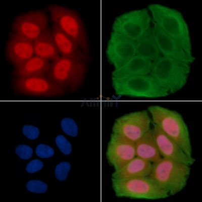 Histone H3 Antibody - AF7836 staining Hela cells(30min of UV treatment) by IF/ICC.