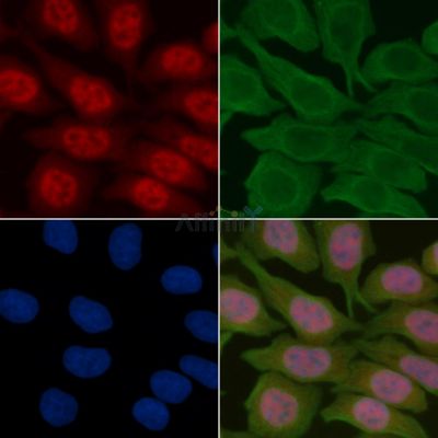 FOXO4 Antibody - AF7841 staining Hela cells(30min of UV treatment) by IF/ICC.