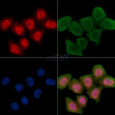TDP43 Antibody - AF7865 staining Hela cells(30min of UV treatment) by IF/ICC.
