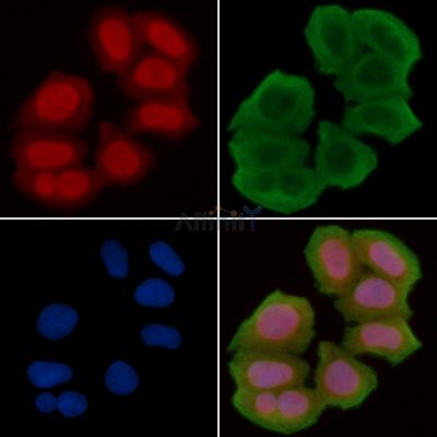 SSH3 Antibody - AF7924 staining Hela cells(30min of UV treatment) by IF/ICC.