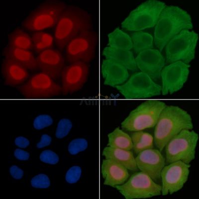Twist1 Antibody - AF7945 staining Hela cells(30min of UV treatment) by IF/ICC.