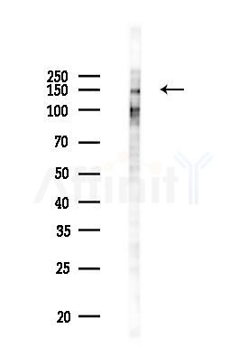 Phospho-PLCG2 (Tyr759) Antibody - Western blot analysis of lysates from PC12 cells(UV 30min treatment), using Phospho-PLCG2 (Tyr759) Antibody at 1/1000 dilution.