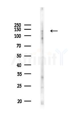 Phospho-HER2/ErbB2 (Tyr1139) Antibody - Western blot analysis of lysates from PC12 cells(UV 30min treatment), using Phospho-HER2/ErbB2 (Tyr1139) Antibody at 1/1000 dilution.
