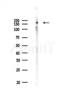 Phospho-Ret (Tyr905) Antibody - Western blot analysis of lysates from PC12 cells(UV 30min treatment), using Phospho-Ret (Tyr905) Antibody at 1/1000 dilution.