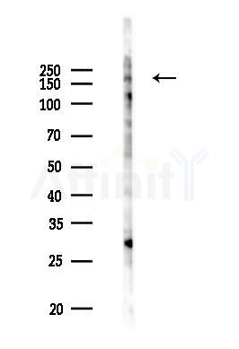 Phospho-Ret (Tyr1096) Antibody - Western blot analysis of lysates from PC12 cells(UV 30min treatment), using Phospho-Ret (Tyr1096) Antibody at 1/1000 dilution.