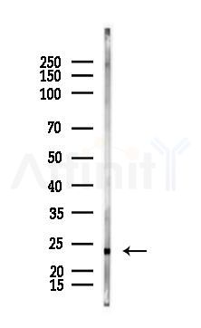 Phospho-HAND1 (Ser98) Antibody - Western blot analysis of lysates from Rat kidney, using Phospho-HAND1 (Ser98) Antibody at 1/1000 dilution.