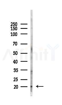 Phospho-HMG17 (Ser29) Antibody - Western blot analysis of lysates from Hela cells(UV 30min treatment), using Phospho-HMG17 (Ser29) Antibody at 1/1000 dilution.