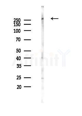 Phospho-IGF2R (Ser2484) Antibody - Western blot analysis of lysates from PC12 cells(heat-shock 45min treatment), using Phospho-IGF2R (Ser2484) Antibody at 1/1000 dilution.