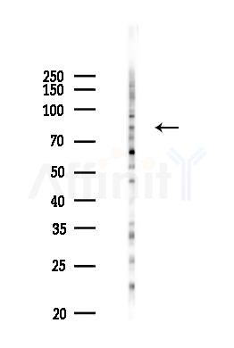 Phospho-Centaurin beta-1 (Ser554) Antibody - Western blot analysis of lysates from PC12 cells(UV 30min treatment), using Phospho-Centaurin beta-1 (Ser554) Antibody at 1/1000 dilution.