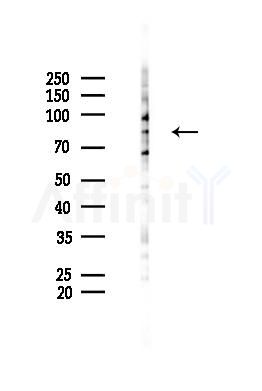 Phospho-Centaurin beta-1 (Ser554) Antibody - Western blot analysis of lysates from COLO205 cells(heat-shock 45min treatment), using Phospho-Centaurin beta-1 (Ser554) Antibody at 1/1000 dilution.