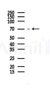 Phospho-Plastin L (Ser5) Antibody - Western blot analysis of lysates from Hela cells(LPS 4h treatment), using Phospho-Plastin L (Ser5) Antibody at 1/1000 dilution.