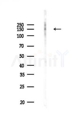 Phospho-ASK1 (Thr838) Antibody - Western blot analysis of lysates from PC12 cells(UV 30min treatment), using Phospho-ASK1 (Thr838) Antibody at 1/1000 dilution.