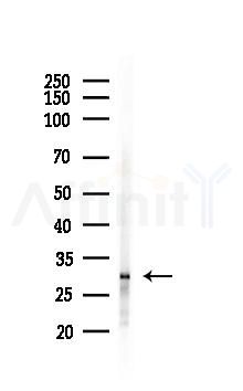 Phospho-Caveolin 2 (Ser36) Antibody - Western blot analysis of lysates from Hela cells(UV 30min treatment), using Phospho-Caveolin 2 (Ser36) Antibody at 1/1000 dilution.