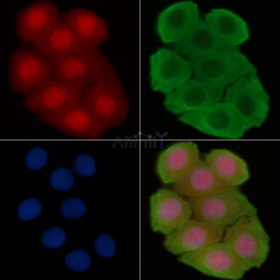 Phospho-Caveolin 2 (Tyr19) Antibody - AF8106 staining Hela cells(30min of UV treatment) by IF/ICC.
