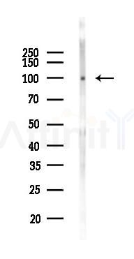 Phospho-IGF1 Receptor (Tyr980) Antibody - Western blot analysis of lysates from Mouse brain, using Phospho-IGF1 Receptor (Tyr980) Antibody at 1/1000 dilution.