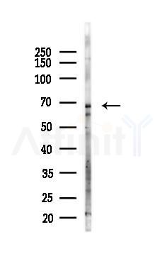 Phospho-Rel (Ser492/Ser460) Antibody - Western blot analysis of lysates from K562 cells(LPS 4h treatment), using Phospho-Rel (Ser492/Ser460) Antibody at 1/1000 dilution.