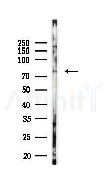 Phospho-STAT4 (Ser721) Antibody - Western blot analysis of lysates from PC12 cells(starvation 24h treatment), using Phospho-STAT4 (Ser721) Antibody at 1/1000 dilution.