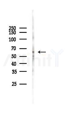 Phospho-VEGFR1 (Tyr1242) Antibody - Western blot analysis of lysates from Hela cells(heat-shock 45min treatment), using Phospho-VEGFR1 (Tyr1242) Antibody at 1/1000 dilution.