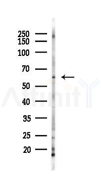 Phospho-BLK (Tyr389) Antibody - Western blot analysis of lysates from K562 cells(LPS 4h treatment), using Phospho-BLK (Tyr389) Antibody at 1/1000 dilution.