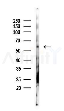 Phospho-BLK (Tyr389) Antibody - Western blot analysis of lysates from Mouse kidney, using Phospho-BLK (Tyr389) Antibody at 1/1000 dilution.