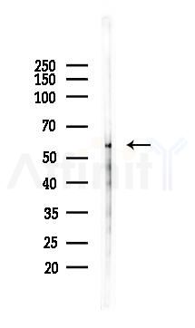 Phospho-BLK (Tyr389) Antibody - Western blot analysis of lysates from Mouse testis, using Phospho-BLK (Tyr389) Antibody at 1/1000 dilution.