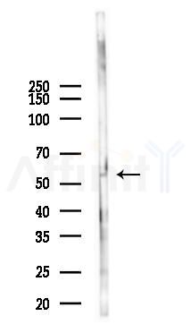 Phospho-BRK (Tyr342) Antibody - Western blot analysis of lysates from Mouse spleen, using Phospho-BRK (Tyr342) Antibody at 1/1000 dilution.