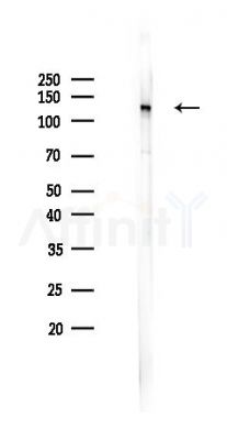 Phospho-DAPK1 (Ser734) Antibody - Western blot analysis of lysates from Mouse brain, using Phospho-DAPK1 (Ser734) Antibody at 1/1000 dilution.